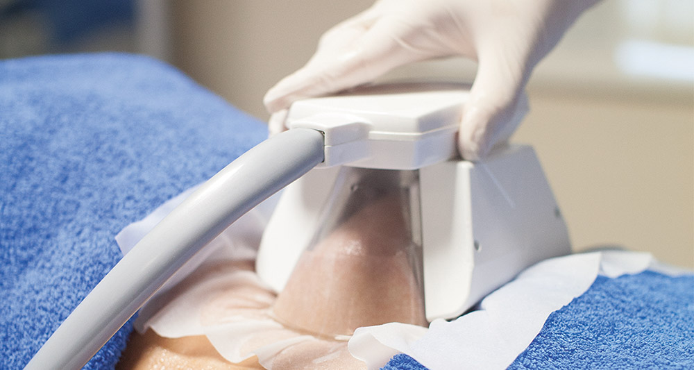 How Fat Freezing and HIFU Work Together? 2 Multiple Areas in One Session HIFU and Fat Freezing Leighton Buzzard