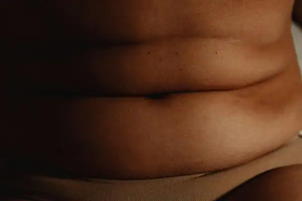 The Hidden Connection: How Stress Shapes Your Fitness and Body Composition 3 image of what stress can do on the stomach area and how Lipo 360 Leighton Buzzard can help to change your body shape.